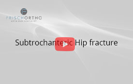 Subtrochanteric Hip fracture