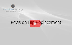Revision Hip Replacement