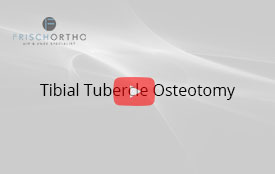 Tibial Tubercle Osteotomy