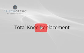 Total Knee Replacement
