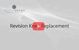 Revision Knee Replacement