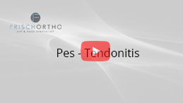Pes Tendonitis