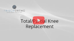 Total/Partial Knee Replacement